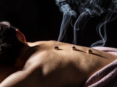 moxibustion